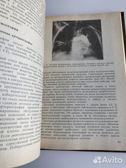 Дж.Рис Диагностические тесты в пульмонологии(1994)