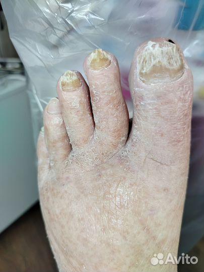 Услуги подолога