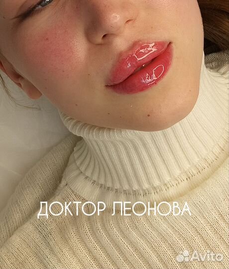 Увеличение губ у врача