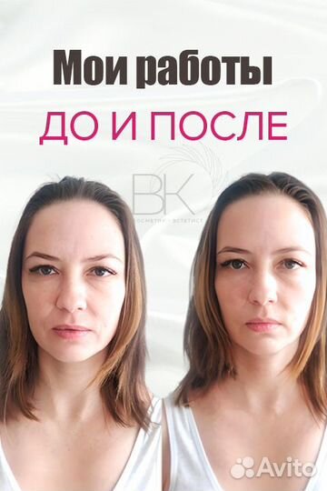 Массаж лица