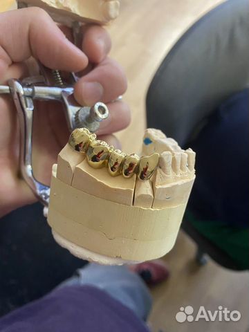 Зубные протезы и ремонт объявление продам