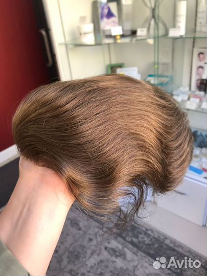 Система замещения волос