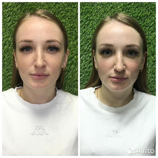 Массаж лица