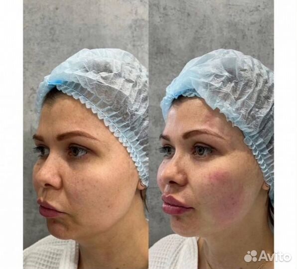 Требуется модель на Альтера