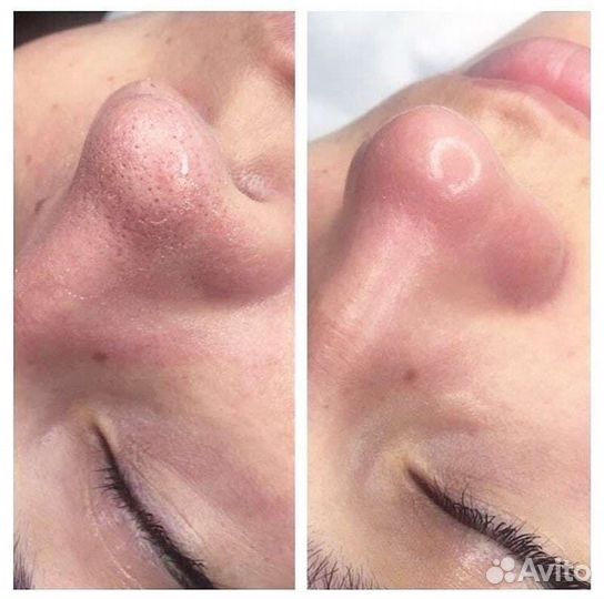 Коррекция фигуры - массаж лица и тела