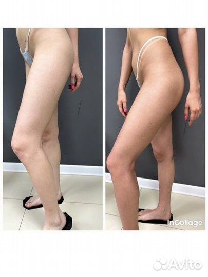 Моментальный загар Выезд