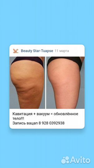 Коррекция фигуры