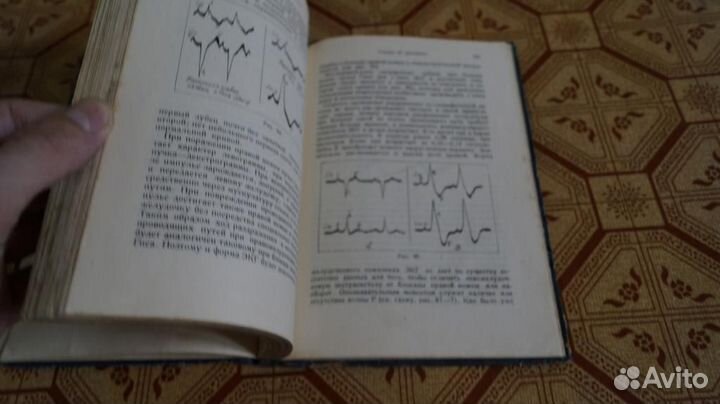 Савицкий Н.Н. Сердце. Методика исследования и диаг