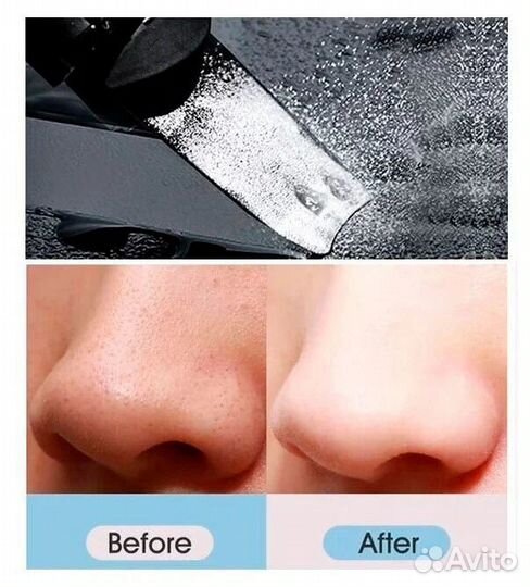 Xiaomi Аппарат для уз чистки лица InFace MS7100