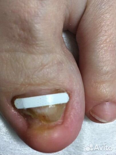 Специалист Подолог, педикюр, маникюр