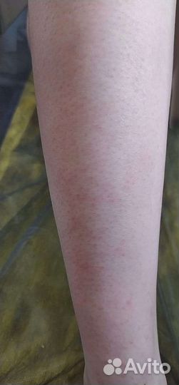 Шугаринг, Спа-процедуры