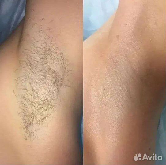 Услуги косметолога