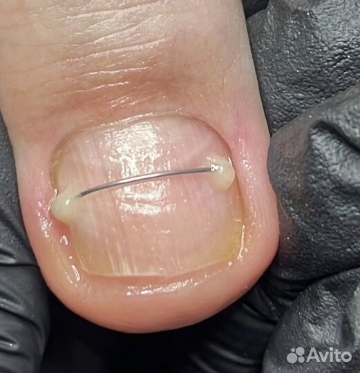 Подолог(педикюр)