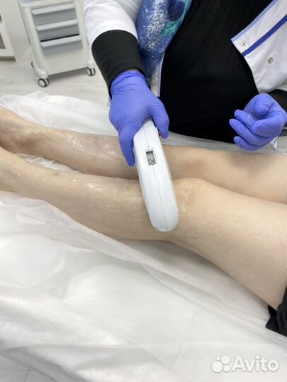 Аппарат лазерной эпиляции SHR KC Riva 1