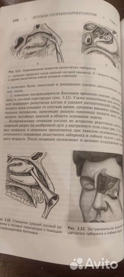 Учебник Детская оториноларингология