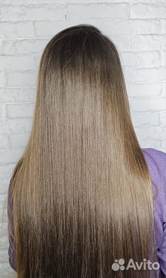 Криотерапия