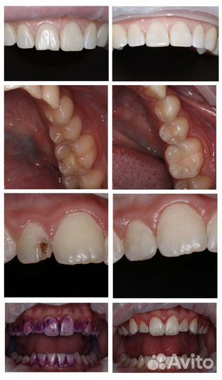 Врач стоматолог терапевт