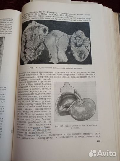 Гинекология