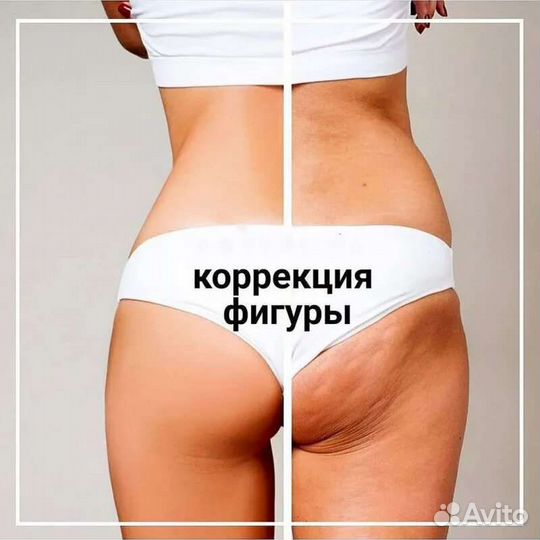Lpg массаж лпдж