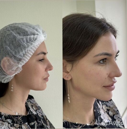 Услуги косметолога