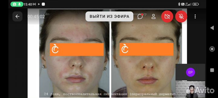 Пилинг WOWэффект