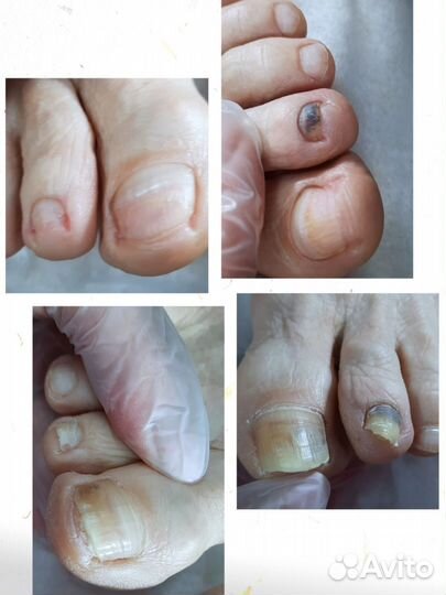 Подолог-педикюр