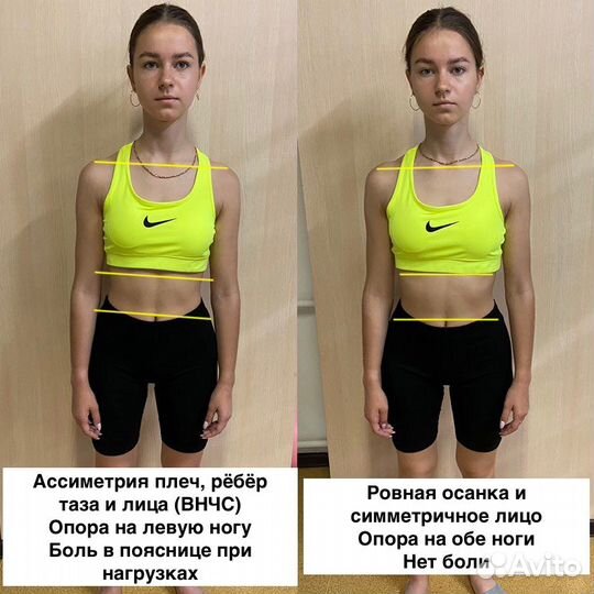 Кинезиолог. ЛФК. Массаж. Коррекция осанки