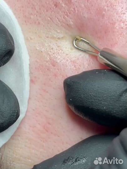 Косметолог- эстетист,массажист