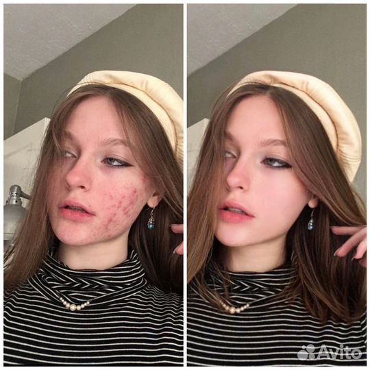 Ретушь фото, обработка фото