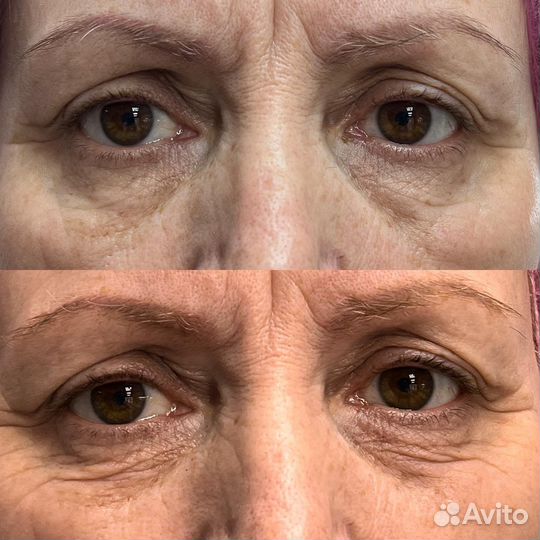 Холодная плазма