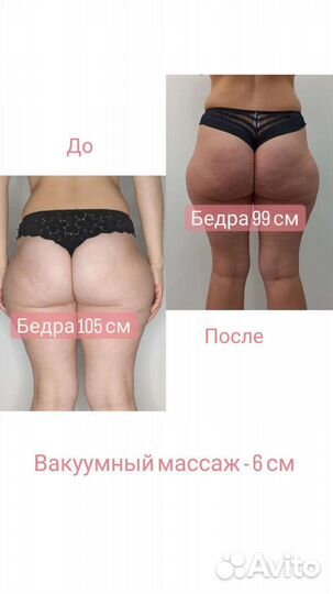 Аппарат коррекции фигуры