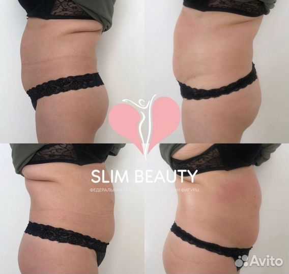 Похудение до 10 кг за курс