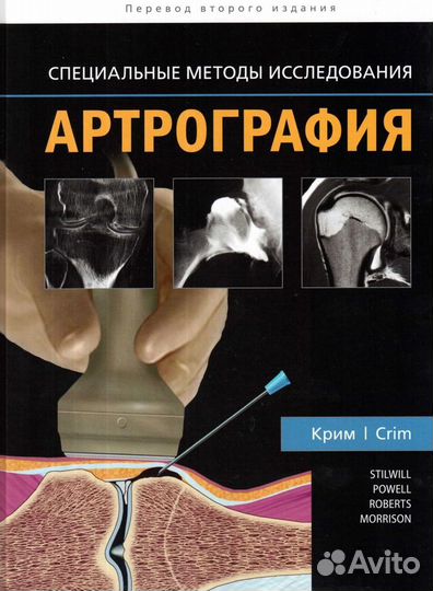 Лучевая диагностика мрт Травматология Ортопедедия