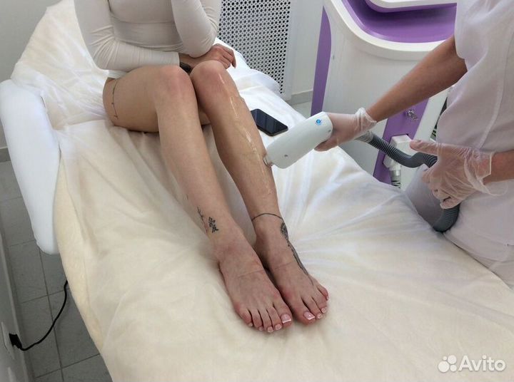 Лазерная эпиляция – готовый бизнес под ключ