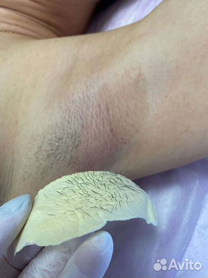 Депиляция,буккальный массаж лиц,чистка лица,брови