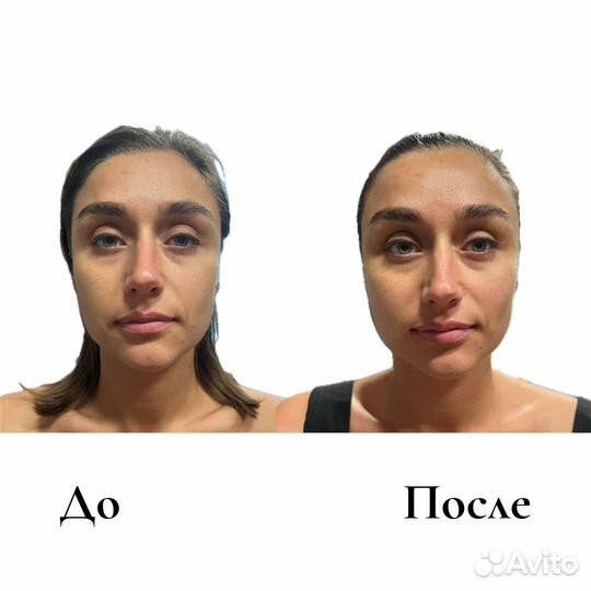 Массаж Лица