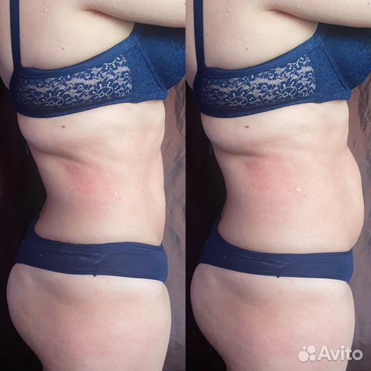 Экспресс-похудение ищу моделей