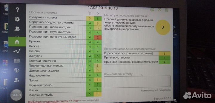 Рофэс-прибор диагностики по аккупунктурным точкам