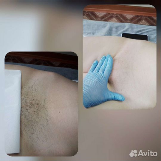 Депиляция(Воск) Южный