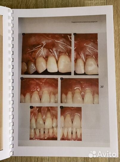 Диагностика и лечение заболеваний пародонта