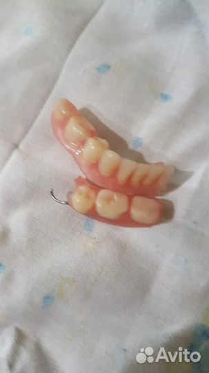 Ремонт акриловых съёмных зубных протезов