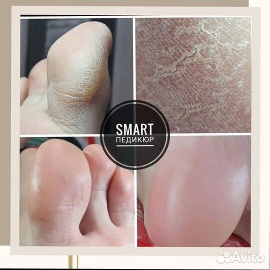 SMART Педикюр