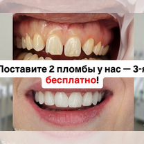 Пломбирование зубов, Махачкала