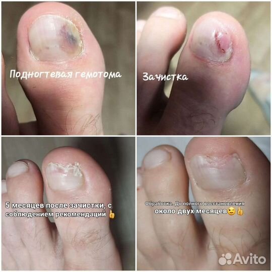 Подология;Педикюр, Маникюр; Наращивание ногтей