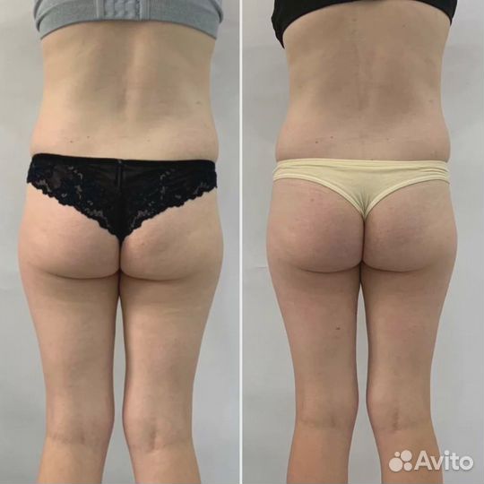 Изоджей -замeняeт двa чaca в cпоpтзaлe-убираем жир