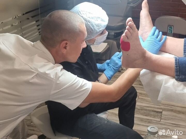 Педикюр вросший ноготь