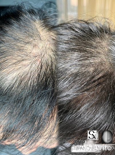 Обучение Трихопигментации