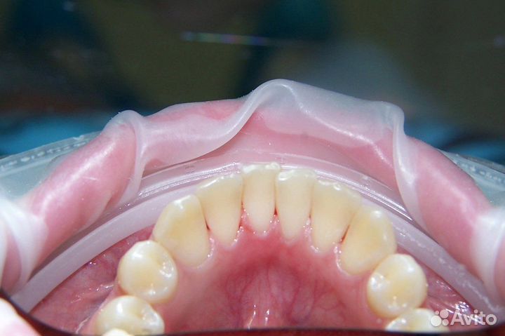 Профессиональная гигиена чистка сертификат