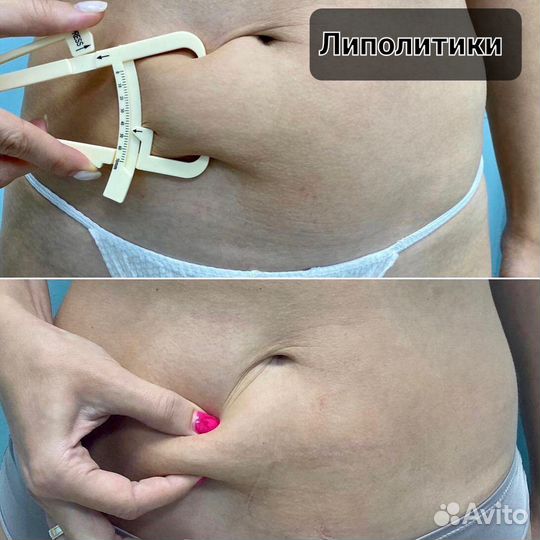 Миостимуляция тела