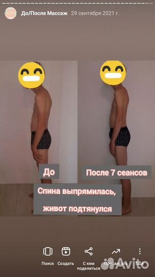 Антицеллюлитный массаж, миофасциальный массаж тела